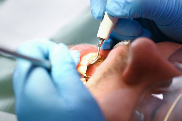 Best Emergency Orthodontic Services in Woodworth, OH