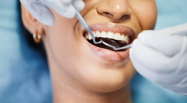 Best Urgent Care for Lost Fillings or Crowns in Woodworth, OH