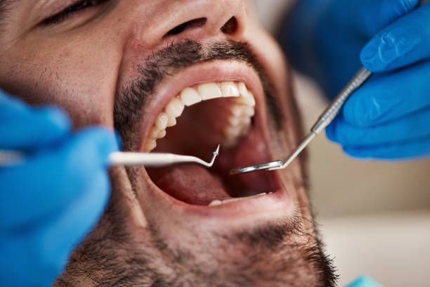 Best Pediatric Emergency Dentist in Woodworth, OH
