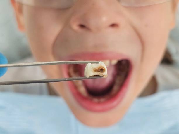 Best Pediatric Emergency Dentist in Woodworth, OH